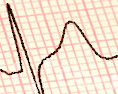 Resume Image